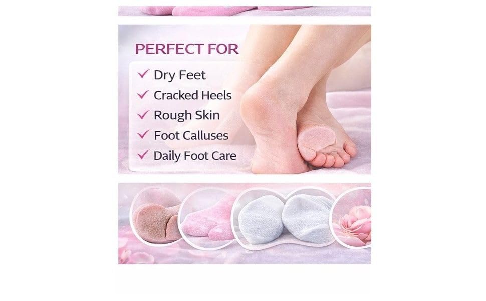 besquestix Moisturizing Gel Heel Socks for Cracked Heels, Silicone Spa Socks for Dry Feet Repair, Heel Pain Relief & Foot Care, Reusable Hydrating Socks for Women , Overnight Heel Softening & Repair Treatment Vitamin E (1 PAIR)(baby pink)