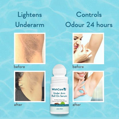 WishCare Underarm Roll On For Women & Men | Reduces Pigmentation, Brightens Skin & Prevents Body Odour | With AHA, Kojic Acid & Hyaluronic Acid | Long Lasting Aqua Fragrance | 50ml