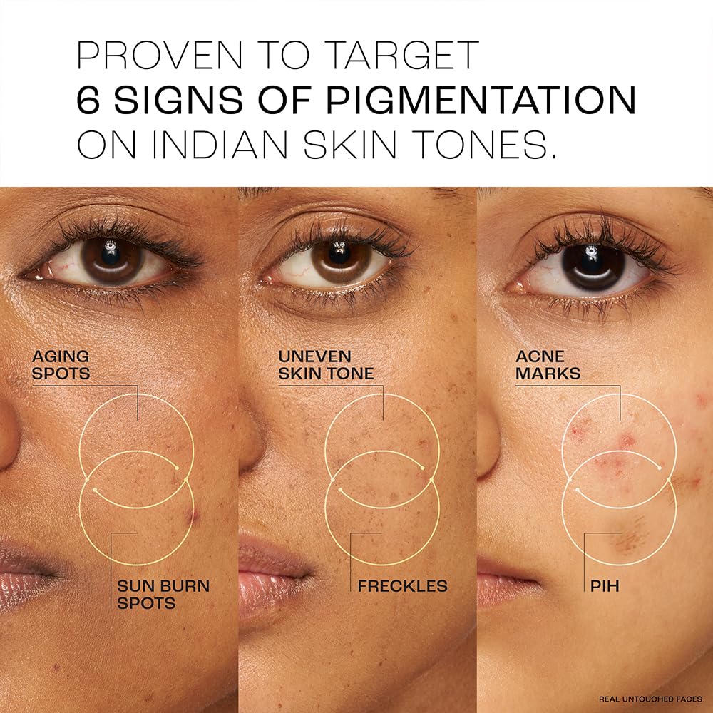 Lakme Perfect Radiance Pigmentation Treatment Day Gel Crème with 10% Niacinamide Resorcinol Complex 7 Antioxidants, 50g [Package might differ]