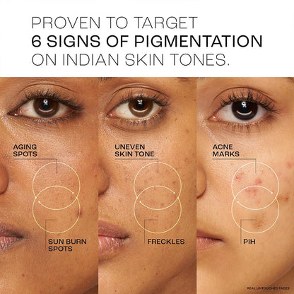 Lakme Perfect Radiance Pigmentation Treatment Day Gel Crème with 10% Niacinamide Resorcinol Complex 7 Antioxidants, 50g [Package might differ]